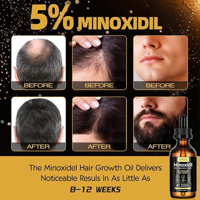 5% Minoxidil Hair Growth Serum Oil For Men and Women, Biotin Hair Serum, Safest Hair Regrowth Treatment, Prevent Scalp Hair Loss 60ml / 2.11 fl.oz